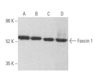 Fascin 1 Antibody (55K-2) - Western Blotting - Image 354642 
