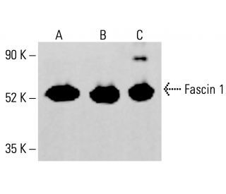 Fascin 1 Antibody (5G112) - Western Blotting - Image 413285 