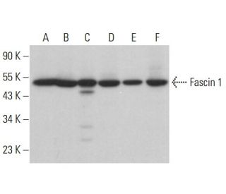 Fascin 1 Antibody (D-10) - Western Blotting - Image 380910 