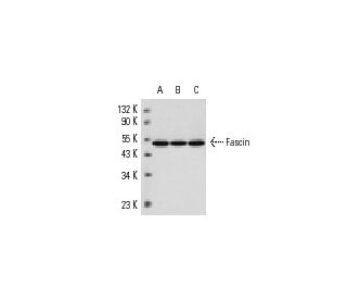 Fascin 1 Antibody (D-10) - Western Blotting - Image 10975