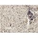 FBP2 Antibody (4C10) - Immunohistochemistry - Image 351759 