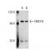 FBXO18 Antibody (2353C1a) - Western Blotting - Image 32747 