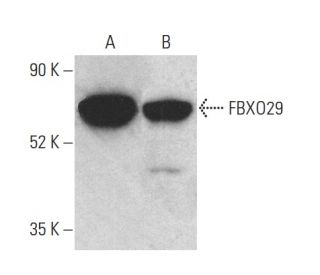 FBXO29 Antibody (D-7) - Western Blotting - Image 400986