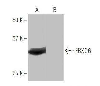 FBXO6 Antibody (7B11) - Western Blotting - Image 64938SAM Transcription Activation: SAM system utilizing dCas9-VP64, MS2-P65-HSF1, and sgRNA for precise gene transcription activation.