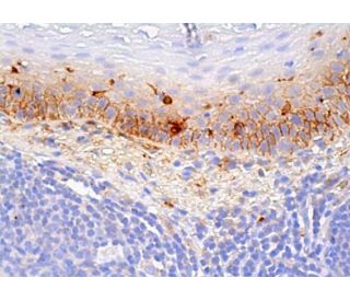 Fc &epsilon; RI&alpha; Antibody (1F2A9) - Immunohistochemistry - Image 384185 