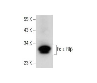 Fc &epsilon; RI&beta; Antibody (F-1) - Western Blotting - Image 309697 