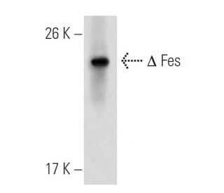 Fes Antibody (2E3G3) - Western Blotting - Image 137449