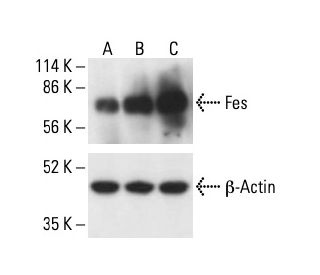 Fes Antibody (5A11G5) - Western Blotting - Image 411205 