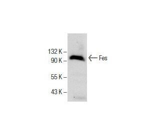Fes Antibody (D-9) - Western Blotting - Image 285967Each CRISPR/Cas9 Knockout (KO) Plasmid product consists of a pool of 3 plasmids designed to ensure identification and cleavage of a specific gene for maximum knockout efficiency. Each plasmid encodes a unique 20 nt sequence derived from the GeCKO (v2) library.