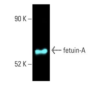 fetuin-A Antibody (H-4) - Western Blotting - Image 402086 