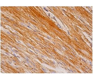 FGF-16 Antibody (G-2) - Immunohistochemistry - Image 346184 