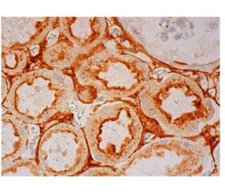 FGF-19 Antibody (H-12) - Immunohistochemistry - Image 302380 