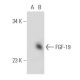FGF-19 Antibody (W12) - Western Blotting - Image 20434