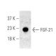 FGF-21 Antibody (G-5) - Western Blotting - Image 395942