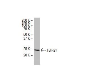 FGF-21 Antibody (Y-16) - Western Blotting - Image 33597 
