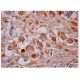 FGF-3 Antibody (MSD 1) - Immunohistochemistry - Image 284902