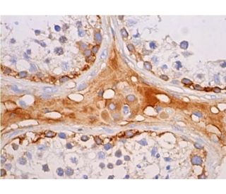 FGFR-3 Antibody (B-9) - Immunohistochemistry - Image 383000 