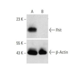 Fhit HDR Plasmid (h): sc-404220-HDR. Western blot analysis of Fhit expression in non-transfected control (A) and puromycinEach CRISPR/Cas9 Knockout (KO) Plasmid product consists of a pool of 3 plasmids designed to ensure identification and cleavage of a specific gene for maximum knockout efficiency. Each plasmid encodes a unique 20 nt sequence derived from the GeCKO (v2) library.