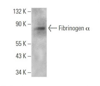 Fibrinogen &alpha; Antibody (471CT12.1.2) - Western Blotting - Image 374595