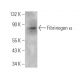 Fibrinogen α Antibody (471CT12.1.2) - Western Blotting - Image 374595