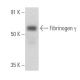 Fibrinogen γ Antibody (2.G2.H9) - Western Blotting - Image 356586 