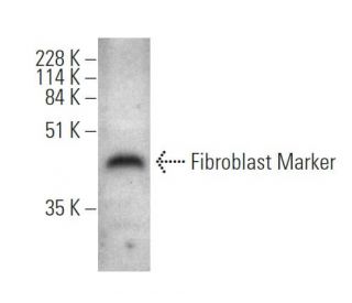 Fibroblast Marker Antibody (ER-TR7) - Western Blotting - Image 370761