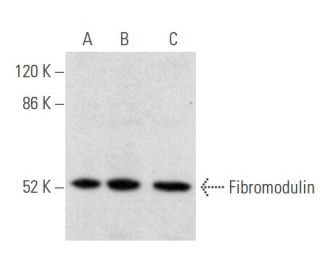 Fibromodulin Antibody (H-11) - Western Blotting - Image 355464Each CRISPR/Cas9 Knockout (KO) Plasmid product consists of a pool of 3 plasmids designed to ensure identification and cleavage of a specific gene for maximum knockout efficiency. Each plasmid encodes a unique 20 nt sequence derived from the GeCKO (v2) library.