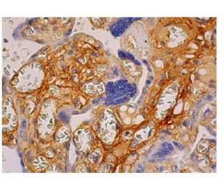 Fibronectin Antibody (EP5) - Immunohistochemistry - Image 349132 