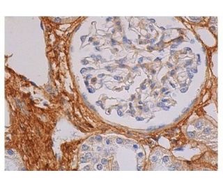 Fibronectin Antibody (TV-1) - Immunohistochemistry - Image 349144 
