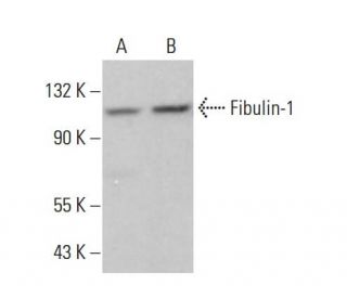 Fibulin-1 Antibody (B-2) - Western Blotting - Image 381948Each CRISPR/Cas9 Knockout (KO) Plasmid product consists of a pool of 3 plasmids designed to ensure identification and cleavage of a specific gene for maximum knockout efficiency. Each plasmid encodes a unique 20 nt sequence derived from the GeCKO (v2) library.