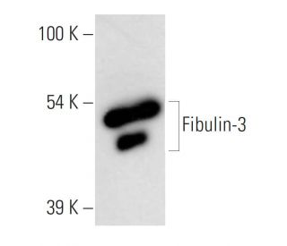 Fibulin-3 Antibody (mab3-5) - Western Blotting - Image 11588 