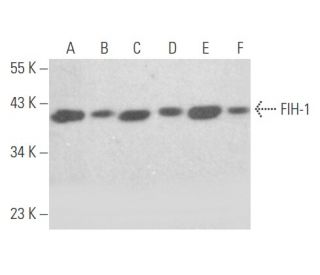 FIH-1 Antibody (D-12) - Western Blotting - Image 356111 