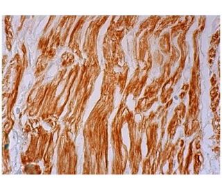 Filamin 1 Antibody (3F180) - Immunohistochemistry - Image 298922 