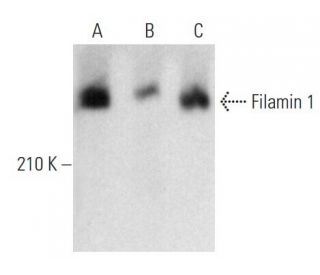 Filamin 1 Antibody (FLMN01) - Western Blotting - Image 353679 