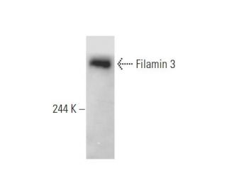 Filamin 3 Antibody (B-7) - Western Blotting - Image 80633 