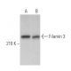 Filamin 3 Antibody (B-7) - Western Blotting - Image 365179 