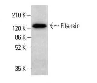 Filensin Antibody (UR12) - Western Blotting - Image 380940Each CRISPR/Cas9 Knockout (KO) Plasmid product consists of a pool of 3 plasmids designed to ensure identification and cleavage of a specific gene for maximum knockout efficiency. Each plasmid encodes a unique 20 nt sequence derived from the GeCKO (v2) library. 