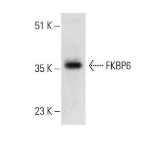 FKBP6 Antibody (AT9B7) - Western Blotting - Image 384189Each CRISPR/Cas9 Knockout (KO) Plasmid product consists of a pool of 3 plasmids designed to ensure identification and cleavage of a specific gene for maximum knockout efficiency. Each plasmid encodes a unique 20 nt sequence derived from the GeCKO (v2) library.