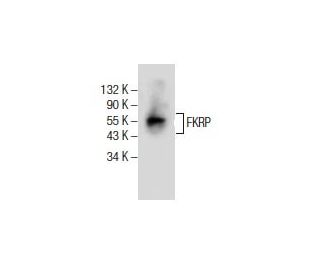FKRP Antibody (E-4) - Western Blotting - Image 154910Each CRISPR/Cas9 Knockout (KO) Plasmid product consists of a pool of 3 plasmids designed to ensure identification and cleavage of a specific gene for maximum knockout efficiency. Each plasmid encodes a unique 20 nt sequence derived from the GeCKO (v2) library. 