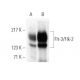 Flt-3/Flk-2 Antibody (SF1.340) - Western Blotting - Image 374114 
