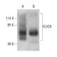 FLVCR Antibody (C-4) - Western Blotting - Image 398488