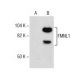 FMNL1 Antibody (D-9) - Western Blotting - Image 285941