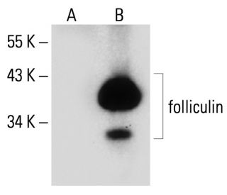 folliculin Antibody (D-4) - Western Blotting - Image 133866 