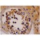 FOP Antibody (B-1) - Immunohistochemistry - Image 286444 