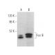 Fos B Antibody (B-10) - Western Blotting - Image 373971 