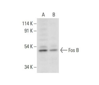 Fos B Antibody (F-7) - Western Blotting - Image 306546