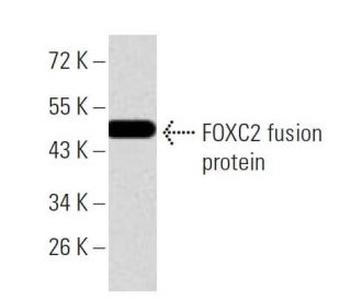 FOXC2 Antibody (1D11C8) - Western Blotting - Image 358290