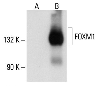 FOXM1 Antibody (D-4) - Western Blotting - Image 93698