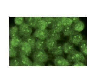 FOXP3 Antibody (2A11G9) - Immunofluorescence - Image 15949 