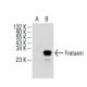 Frataxin Antibody (C-2) - Western Blotting - Image 393527
